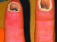 莲蓬乳和空手指图