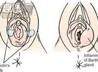 真人演示前庭球图片