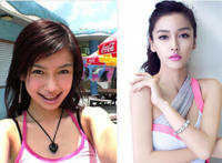 整容最成功的明星