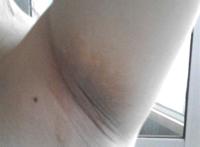 宝妈们怀孕以后腋下变的很黑脖子黑