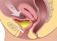 下面很紧是什么原因