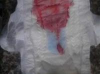 垃圾桶卫生巾血图片 垃圾桶卫生巾血图片