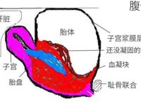 胎内寄生子宫〖坑文〗