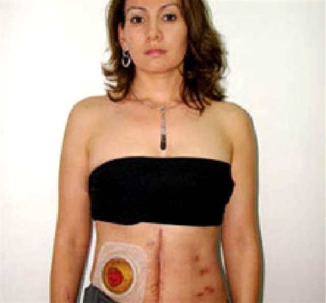 墨西哥美女市长裸露身体(点击浏览下一张趣图)
